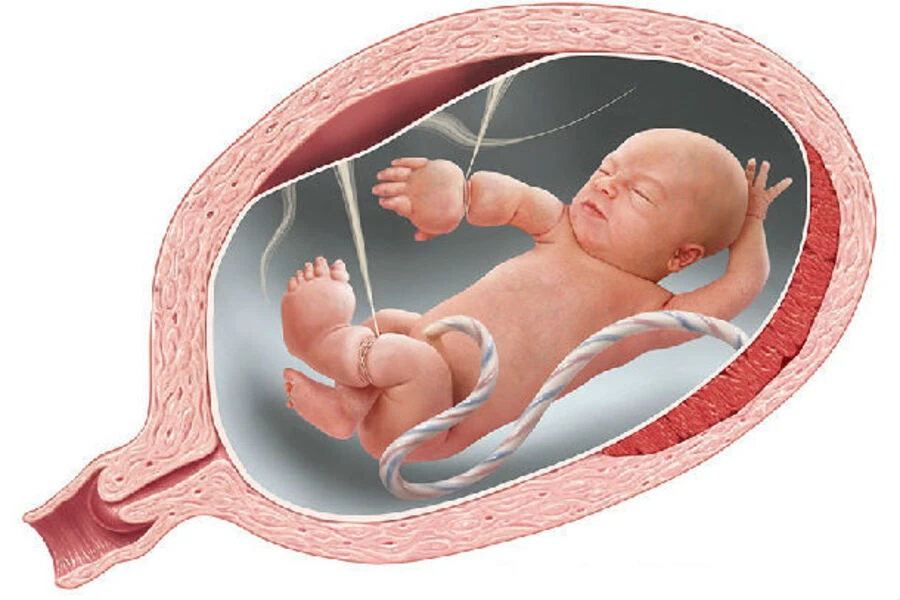 Nguyên nhân và cách khắc phục hội chứng dải sợi ối ở thai nhi: Hiểm nguy cần nhận diện sớm để cứu trẻ ngay từ trong bụng mẹ