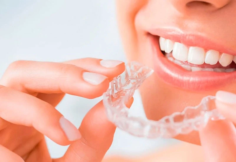 5 lý do niềng răng Invisalign được ưa chuộng tại Nha khoa Quốc tế Phú Hòa