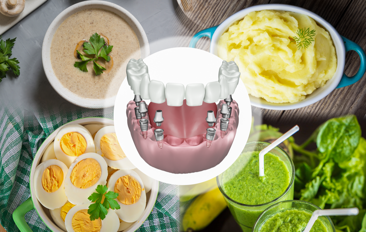3 Cách Giảm Đau Hiệu Quả Khi Cấy Răng Implant